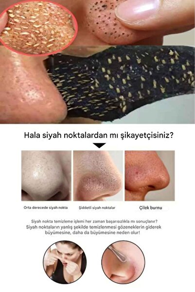 MİNGODAN 5 Adet Siyah Nokta - Gözenek Arındırıcı Temizleyici Burun Bandı 5'li Siyah Nokta Temizleme Maskeleri