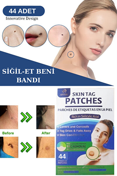 Uni zer Siğil Et Beni Bandı Skin Tag 44'lü Salisilik Asitli Hidrokolloid Formüllü Cilt Temizleme Bandı