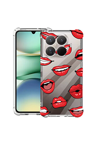 bestcase Carcasă antișoc pentru Xiaomi 15T Pro, cu design Lips - model de săr...