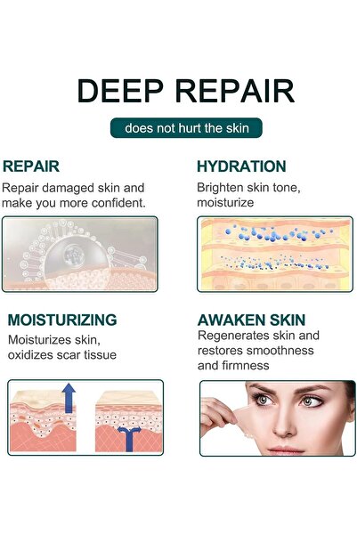 Bukela Medical Grade Silicone Scar Tape - Scar Removal Strips for Acne, C-section, Keloids, 1.6×62.