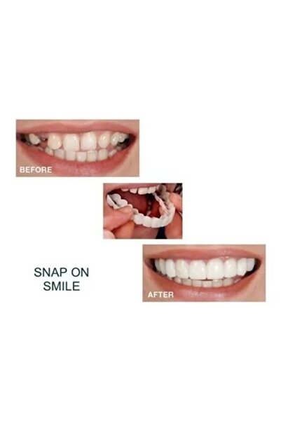 Generic A pair of reusable teeth whitening dental care accessories, multiple colors, 7*7*7cm