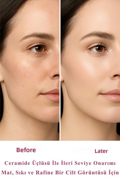 La Rachel Smooth and Radiant Skin Like Glass – Lifting in 5 Minutes + Patented Ceramide Barrier Repair |   Paris