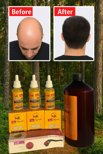 NUH محلول الشعر الأشقر