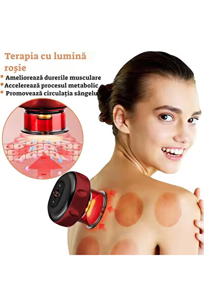 CenturyLux Electric Vacuum Anti-Cellulite Massager – Integrated Heating, 2 Pressure Modes, USB