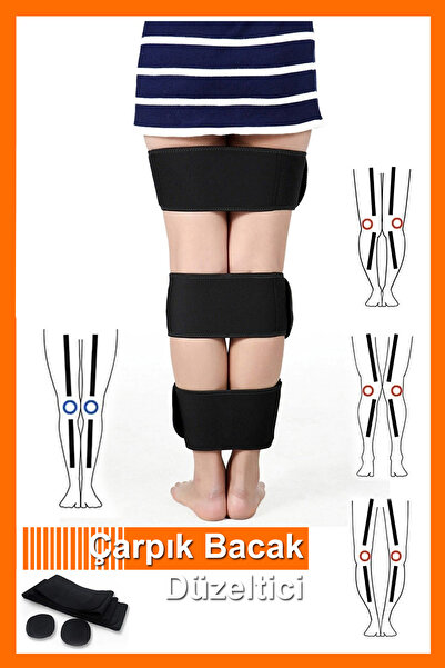 Bundeba Crus Leg Crooked Relief Crooked Leg Corrector Corset 3 Pieces Set Tape