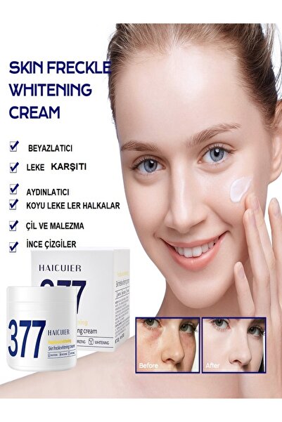 377 Kore Kremi Beyazlatıcı Güzellik Kremi koyu Halkalar lekeler, çiller,melaz...