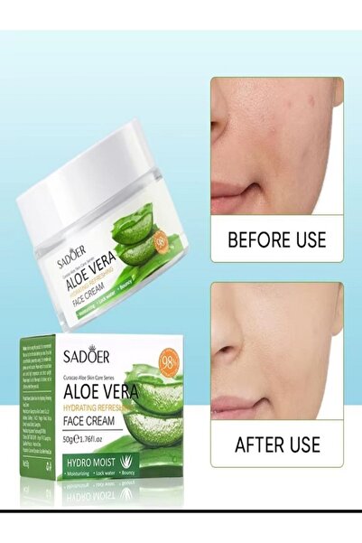 SADOER Aloe Vera Nemlendirici Sıkılaştırıcı Besleyici Onarıcı Aydınlatıcı Yüz Cilt Derin Leke Karşıtı Bakım