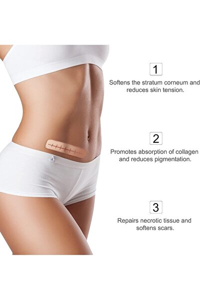 Bukela Medical Grade Silicone Scar Tape - Scar Removal Strips for Acne, C-section, Keloids, 1.6×62.