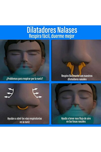 Bukela Silicone Nasal Dilators, 4 Pieces — Reduce Snoring & Improve Breathing