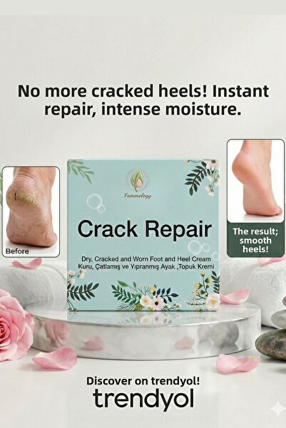 Femmelogy كريم إصلاح تشققات الكعب للعناية بالقدمين، مرطب مكثف، فعال ضد الجلد ...