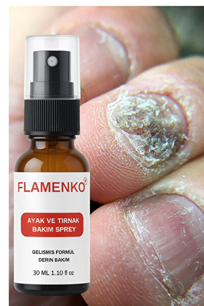 FLAMENKO Koku Önleyici Ayak Mantar Kaşınma Önleyici Sprey 30 ML