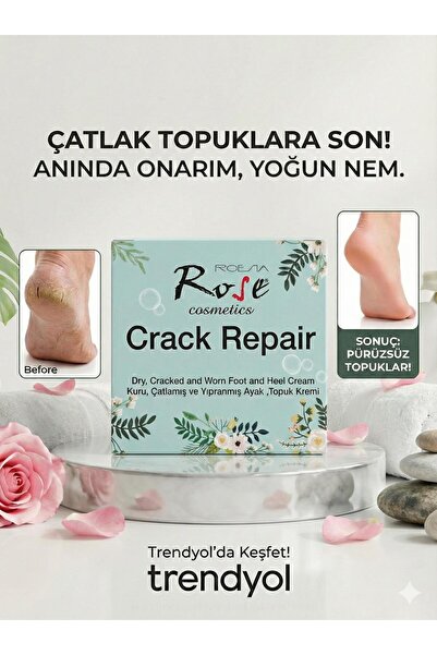 Roesıa Rose Cosmetics Ayak Ve Topuk Çatlak Kremi