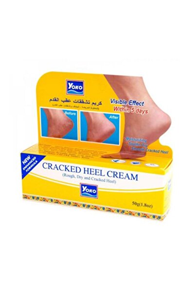 YOKO Heel Crack Repair Cream – 50 g