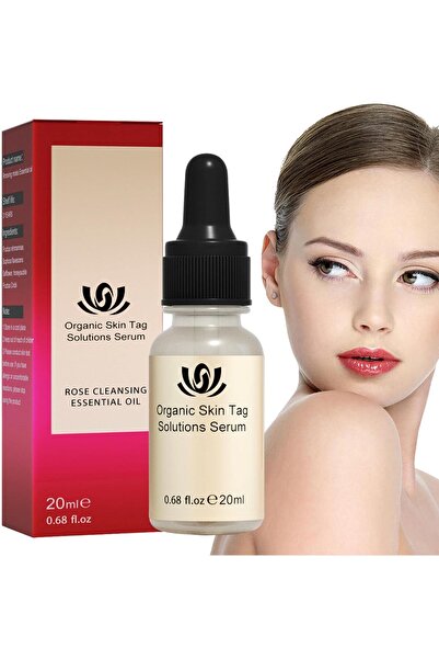 EELOHE 5 Pc Essential Oil Mole and Wart Remover, Natural Herbal Extract, 20 ml