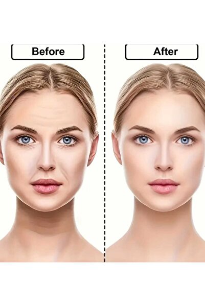 NİRA VERO 48lı yüz germe bandı ,alın,yanak,göz altı,boyun,ince kırışıklık kal...