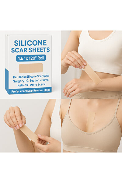 SCAR Silicone Sheets – 1.6” x 120” Roll – Reusable Silicone Tape for Surgery