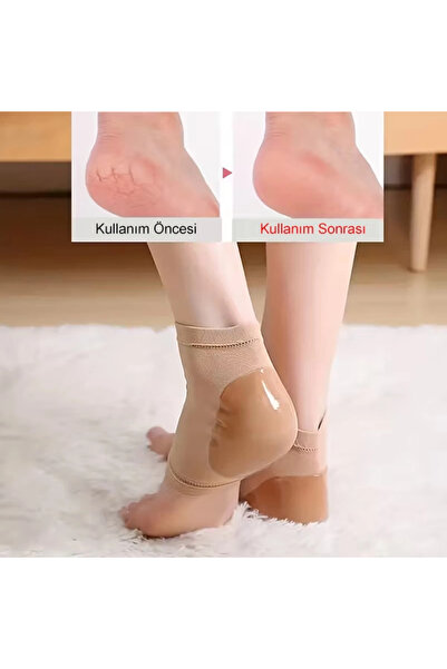 Genel Markalar 1 Çift Silikon Nemlendirici Topuk Çorabı Çatlak Nasır İçin Nem...