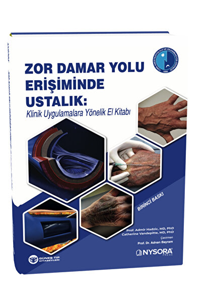 Güneş Tıp Kitabevleri NYSORA - Zor Damar Yolu Erişiminde Ustalık: Klinik Uygulamalara Yönelik El Kitabı