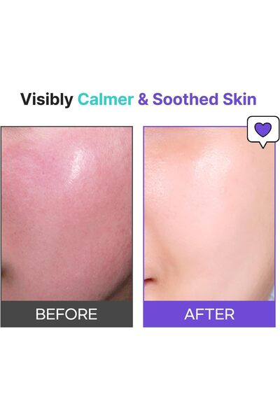 TİAM TIA'M Snail & Azulene Calmfort Cream 100 ml - Soothing Face Cream for Sensitive Skin