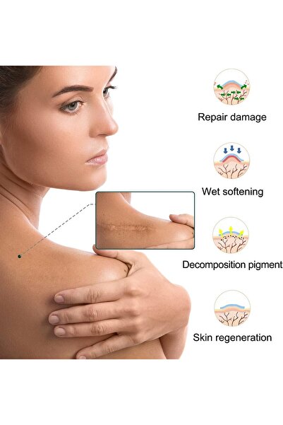 Bukela Medical Grade Silicone Scar Tape - Scar Removal Strips for Acne, C-section, Keloids, 1.6×62.