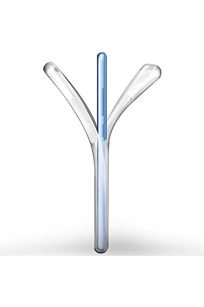 HTstore Xiaomi Compatible Mi 11 Lite Case Zore Enjoy Sleeve