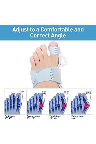 Bukela Defsedar Grey Bunion Corrector, Adjustable Knob Toe Straightener (Left/Right)