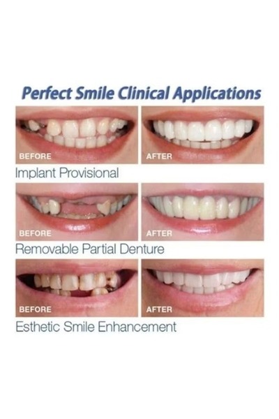 Generic A pair of reusable teeth whitening dental care accessories, multiple colors, 7*7*7cm