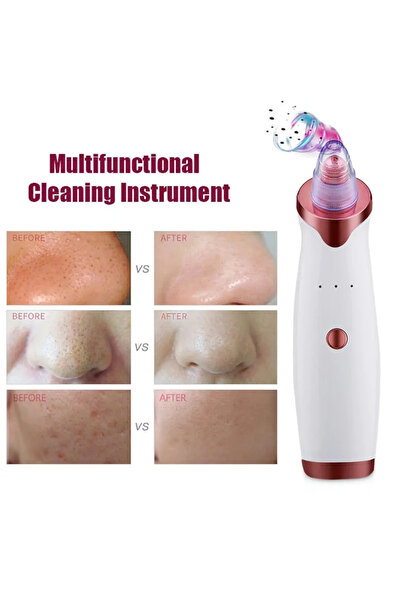 OEM Dispozitiv de microdermabraziune cu pulbere de diamant pentru lifting și fermitate