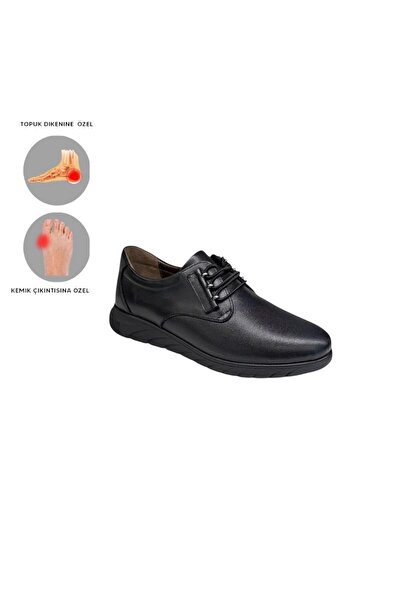 MİRATERLİK ORTOPEDİK TERLİK VE AYAKKABI Mira Orthopedic Women's Leather Shoes Are Suitable for Feet with Heel Spurs, Bone Protrusions, and Scalloped Feet