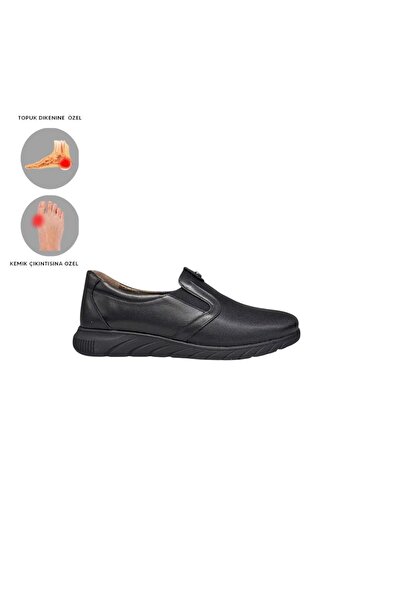 MİRATERLİK ORTOPEDİK TERLİK VE AYAKKABI Mira Orthopedic Women's Leather Shoes Are Suitable for Feet with Heel Spurs, Bone Protrusions, and Scalloped Feet