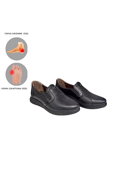 MİRATERLİK ORTOPEDİK TERLİK VE AYAKKABI Mira Orthopedic Women's Leather Shoes Are Suitable for Feet with Heel Spurs, Bone Protrusions, and Scalloped Feet