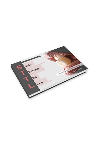 OEM Carte de fotografie dentară - Smile Trough The Lens - Un ghid complet pentru fotografia dentară