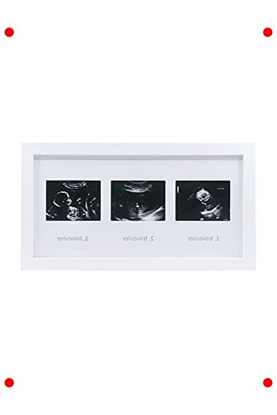 markentegra Triple Ultrasound Memory Frame - Preserve Your Memories