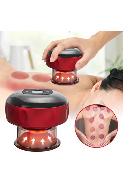 OEM Vacuum-Cup Massage Device, USB Rechargeable, Anti-Cellulite, 12 Heat & Pressure Levels, 1900mAh