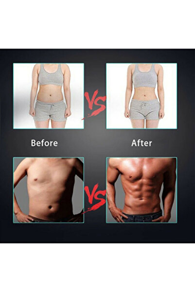 Reflection Vision EMS Muscle Stimulator 5-in-1 (Glutes, Abdomen, Arms, Neck)