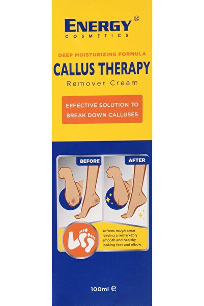 Energy Cosmetx Foot Skin Removal Cream, 100 ml, 3430205