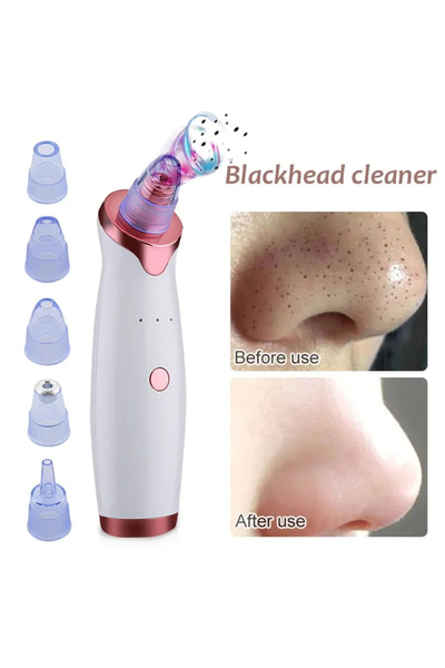 OEM Dispozitiv de microdermabraziune cu pulbere de diamant pentru lifting și fermitate