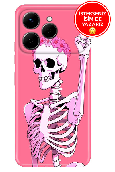 TECNO Spark 40 4G Kılıf Kamera Koruma Rubber Esnek Silikon Missskull