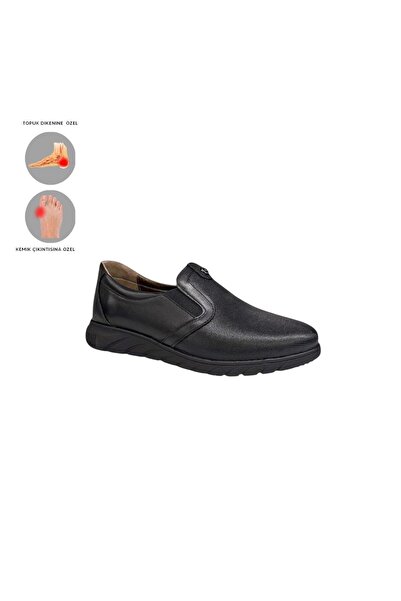 MİRATERLİK ORTOPEDİK TERLİK VE AYAKKABI Mira Orthopedic Women's Leather Shoes Are Suitable for Feet with Heel Spurs, Bone Protrusions, and Scalloped Feet
