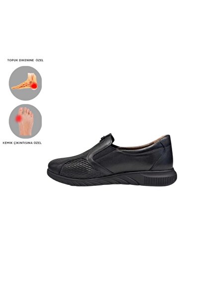 MİRATERLİK ORTOPEDİK TERLİK VE AYAKKABI Mira Orthopedic Women's Leather Shoes Are Suitable for Feet with Heel Spurs, Bone Protrusions, and Scalloped Feet