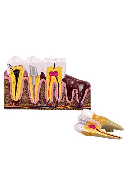 KESNUP Anatomical tooth mold model, 16.1 x 12.5 cm, mold 13.8 x 8.5 x cm, resin material, Multicolor