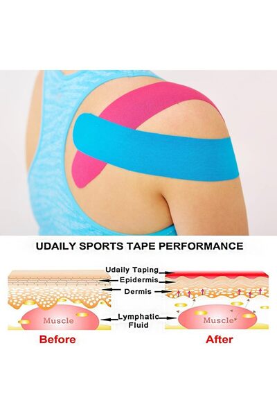 NALACAL Kinesiology Tape Precut, 40 Strips Pro Elastic Athletic Tape