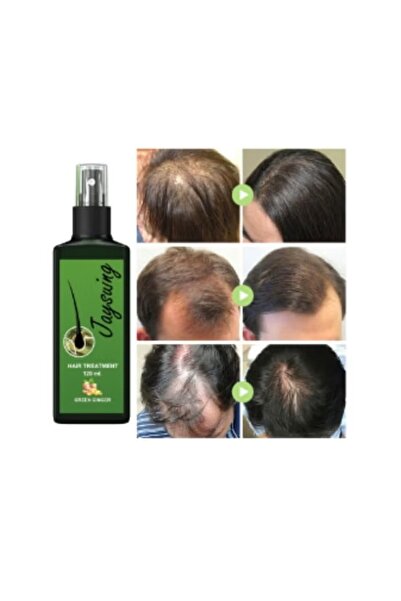 Water Ice Levin Men's Dense Essential Oil Hair Care Serum - Revitalize Thin Hair