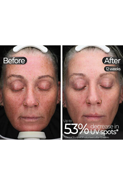 Stylpro Wavelength Pro 5-in-1 LED Mask