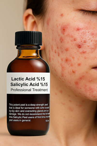 Puredermine حمض اللاكتيك 15% + حمض الساليسيليك 15% تقشير كيميائي - تقشير احتر...