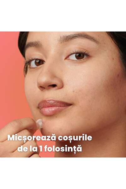 Zenessy Anti-Acne Pimple Patches, Hydrocolloid Strips, Transparent, 36 Pieces