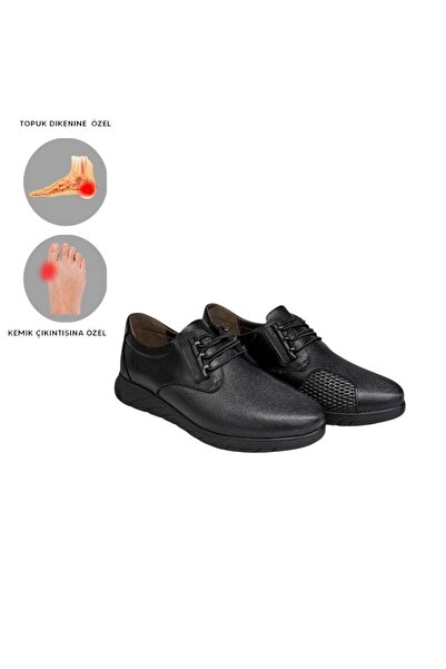 MİRATERLİK ORTOPEDİK TERLİK VE AYAKKABI أحذية ميرا الجلدية النسائية لتقويم ال...