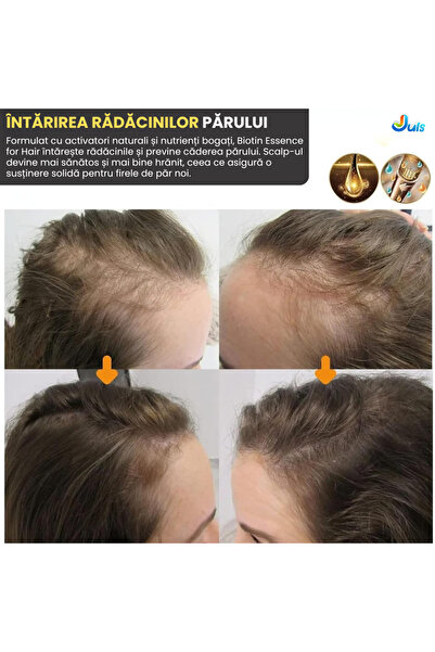 Full Abundance 10 bucati Biotin Hair Serum – Fast Growth Treatment, Strengthens Hair, Reduces Hair Loss