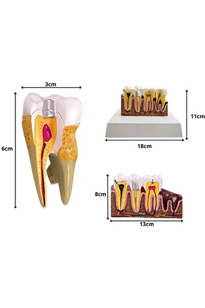 KESNUP Anatomical tooth mold model, 16.1 x 12.5 cm, mold 13.8 x 8.5 x cm, resin material, Multicolor