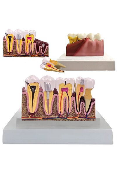 KESNUP Anatomical tooth mold model, 16.1 x 12.5 cm, mold 13.8 x 8.5 x cm, resin material, Multicolor